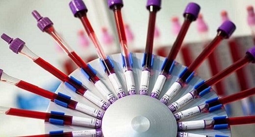 Does Science Support The Blood Type Diet? Awaken